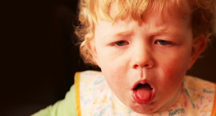 Síntomas de tos ferina en niños