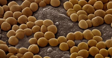 Conoce los diferentes tipos de bacterias Coccus: características y ejemplos
