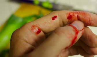 lesiones más comunes en la cocina
