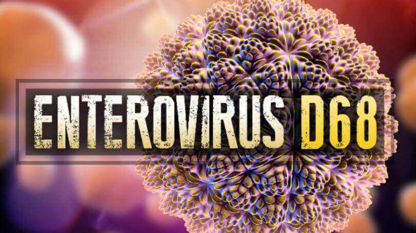 ¿Cuál es la definición de enterovirus? ¿Cuáles son las características de Enterovirus?