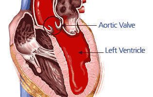 ¿Qué es la Aorta? Funciones de la Aorta y Enfermedades de la Aorta