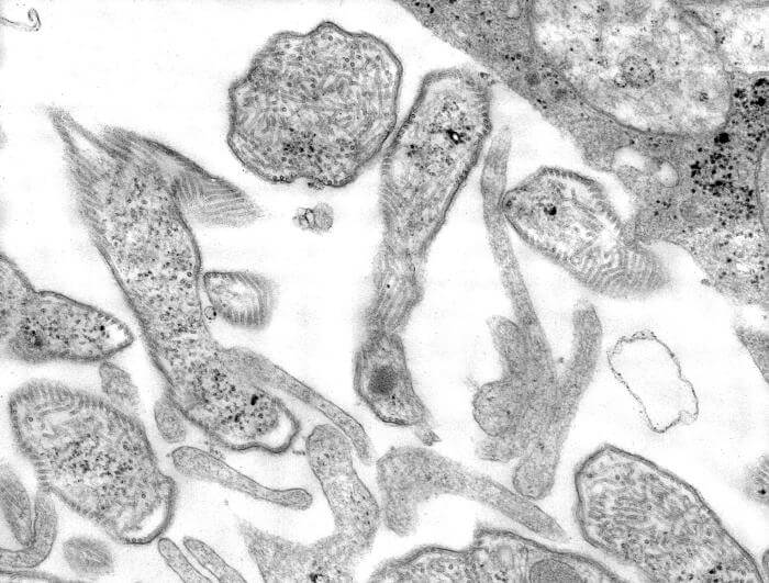 Esta imagen de 1977 de microscopio electrónico de transmisión de sección delgada (TEM) mostraba los detalles ultraestructurales exhibidos por las partículas del virus de las paperas que habían crecido en un cultivo de células Vero.