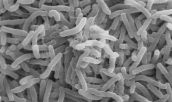 Imagen de microscopio electrónico de barrido de Vibrio cholerae