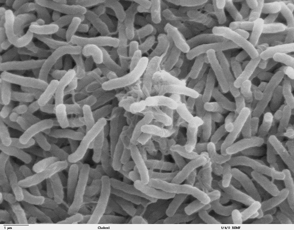 Imagen de microscopio electrónico de barrido de Vibrio cholerae 